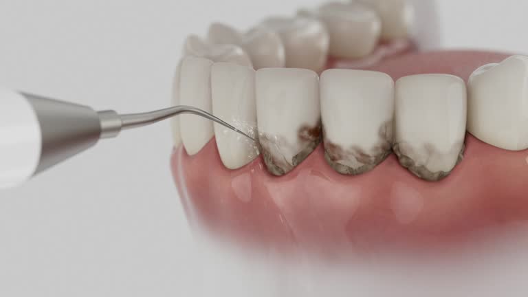 Trusted Emergency Dentist service in Jackson, MI - Dentist Open Now
